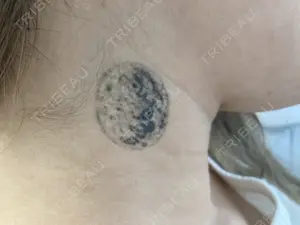 before image