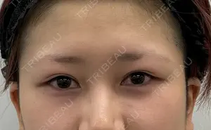 before image