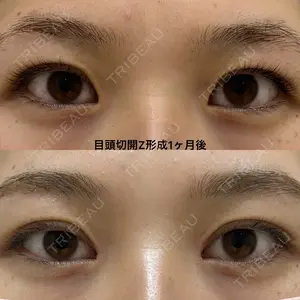 before image