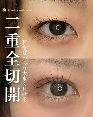 30 days after image