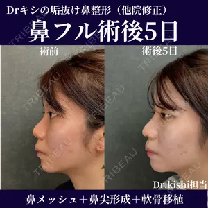 before image