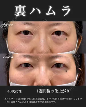 7 days after image
