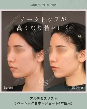 3 days after image