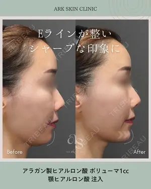 0 days after image