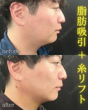 7 days after image