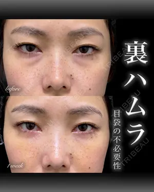 before image