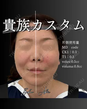 before image
