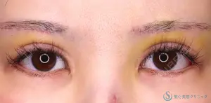 5 days after image