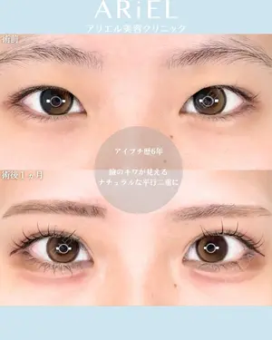 before image