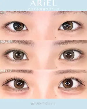 30 days after image