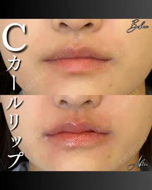 before image
