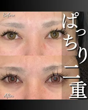 before image