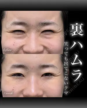 before image