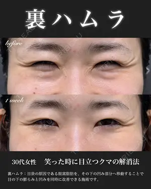 7 days after image