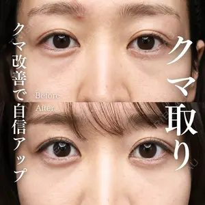 30 days after image