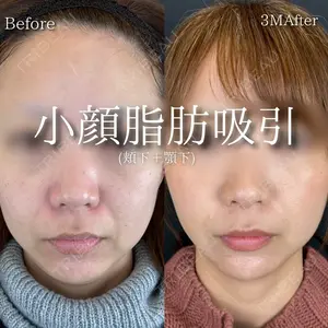 90 days after image