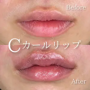 0 days after image