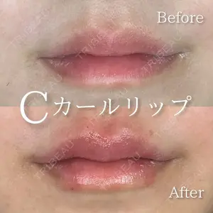 0 days after image