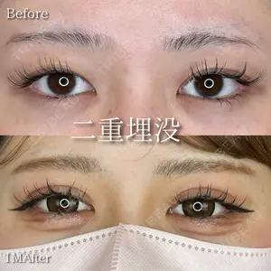 30 days after image