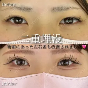 30 days after image