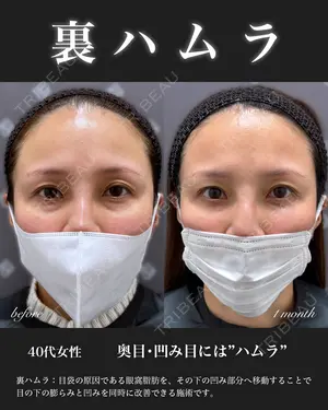 30 days after image