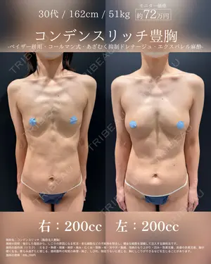 30 days after image