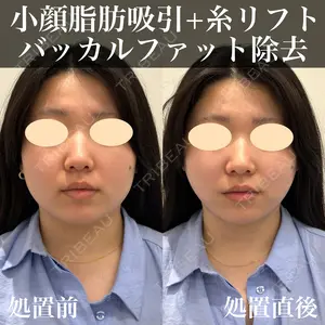30 days after image