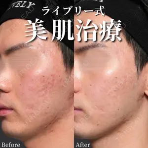 before image
