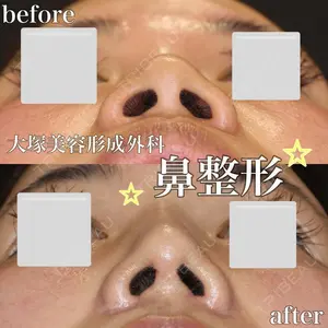 null days after image