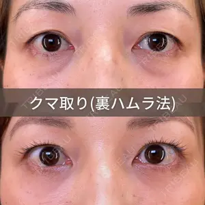 30 days after image