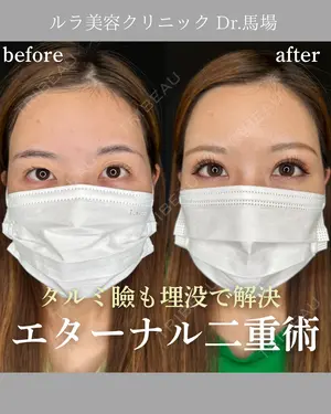 before image