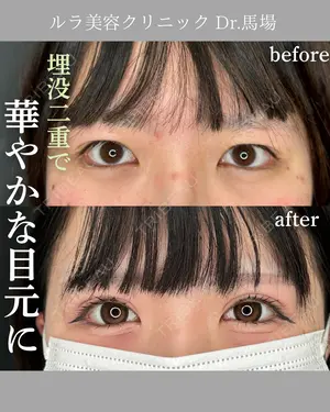 before image