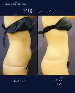 before image