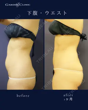 before image