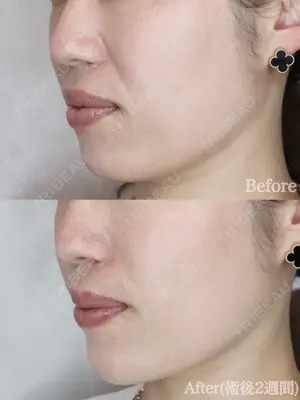 before image