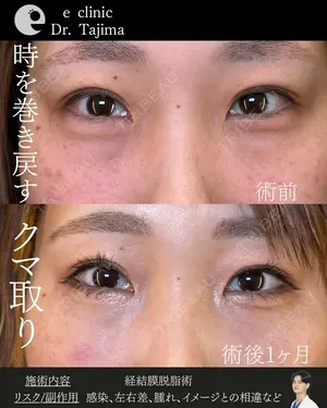 30 days after image