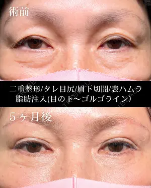 150 days after image