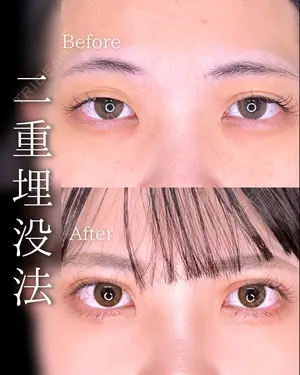 before image