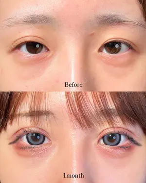 before image