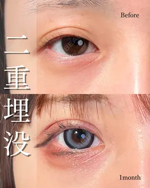 30 days after image
