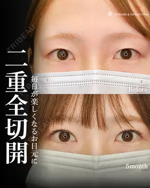 150 days after image