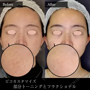 30 days after image