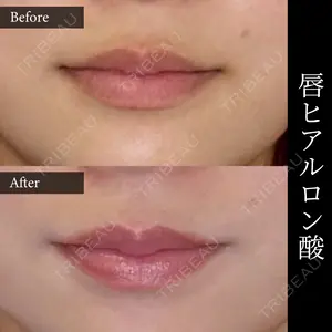 30 days after image