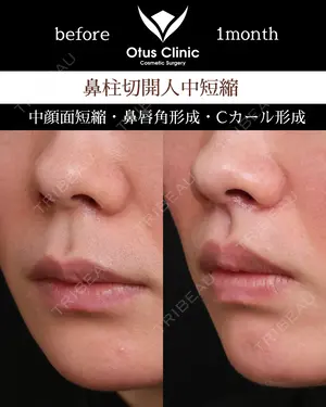 30 days after image