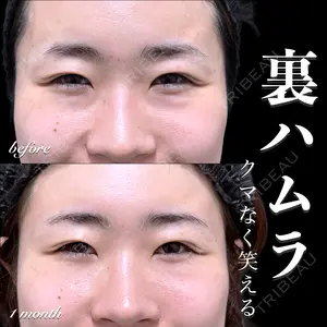 30 days after image
