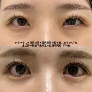 before image