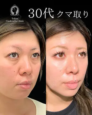 before image