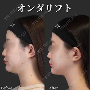 before image