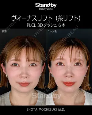 30 days after image