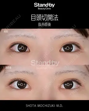 before image